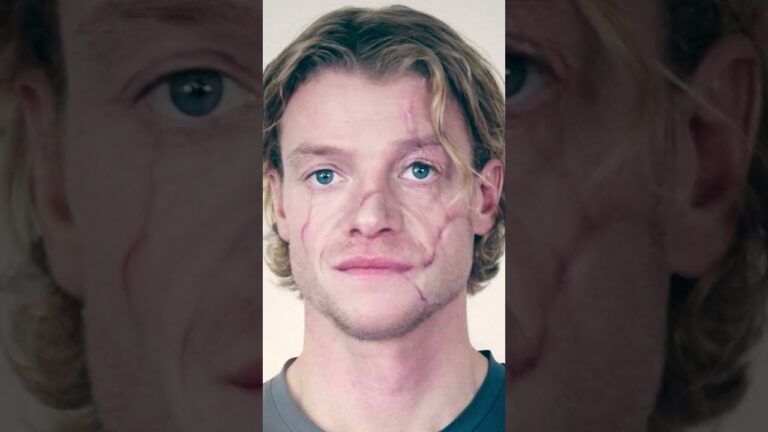 this a listers shockingly gruesome procedure must be seen to be believed tsr investigates c9Ekut